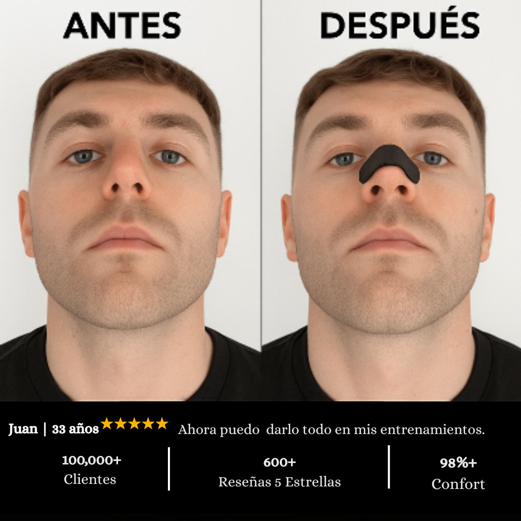 NoseForce™ | Dile Adiós al Taponamiento Nasal.