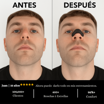 NoseForce™ | Dile Adiós al Taponamiento Nasal.